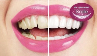 [MẪU MỚI] Kem đánh răng CREST 3D White Advanced Triple Whitening 158g