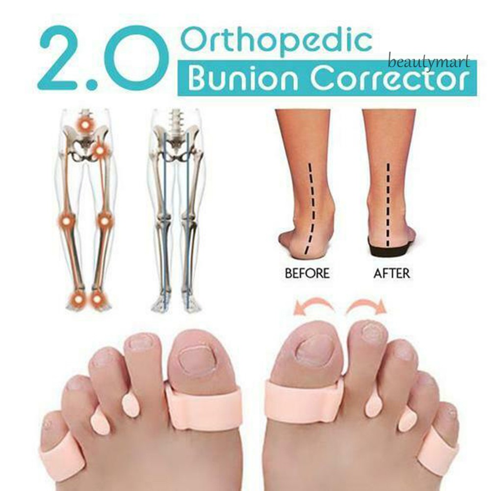 [Hàng mới về] Dụng cụ tách ngón chân chồng chéo lên nhau điều chỉnh sự biến dạng ngón chân cái