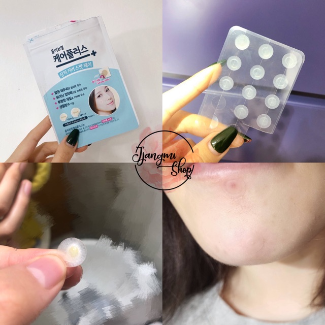 Miếng dán mụn Careplus Olive Young / Care Plus Scar Cover Spot Patch