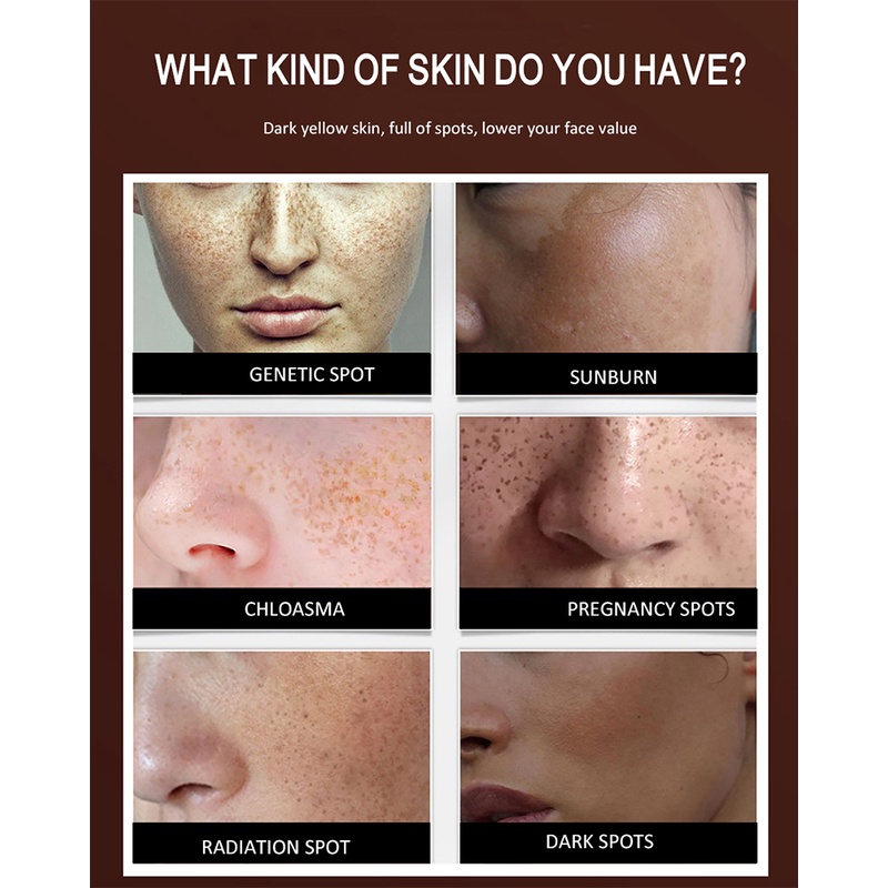 beautysecret kem dưỡng trắng da mặt chiết xuất thực vật loại bỏ tàn nhang 30g | BigBuy360 - bigbuy360.vn