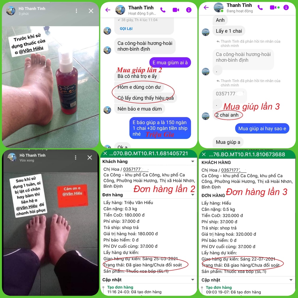 Dầu Xoa Bóp Triệu Gia Phục Hồi Viêm Gân, Bong Gân, Giãn Dây Chằng, Đau Nhức Xương Khớp