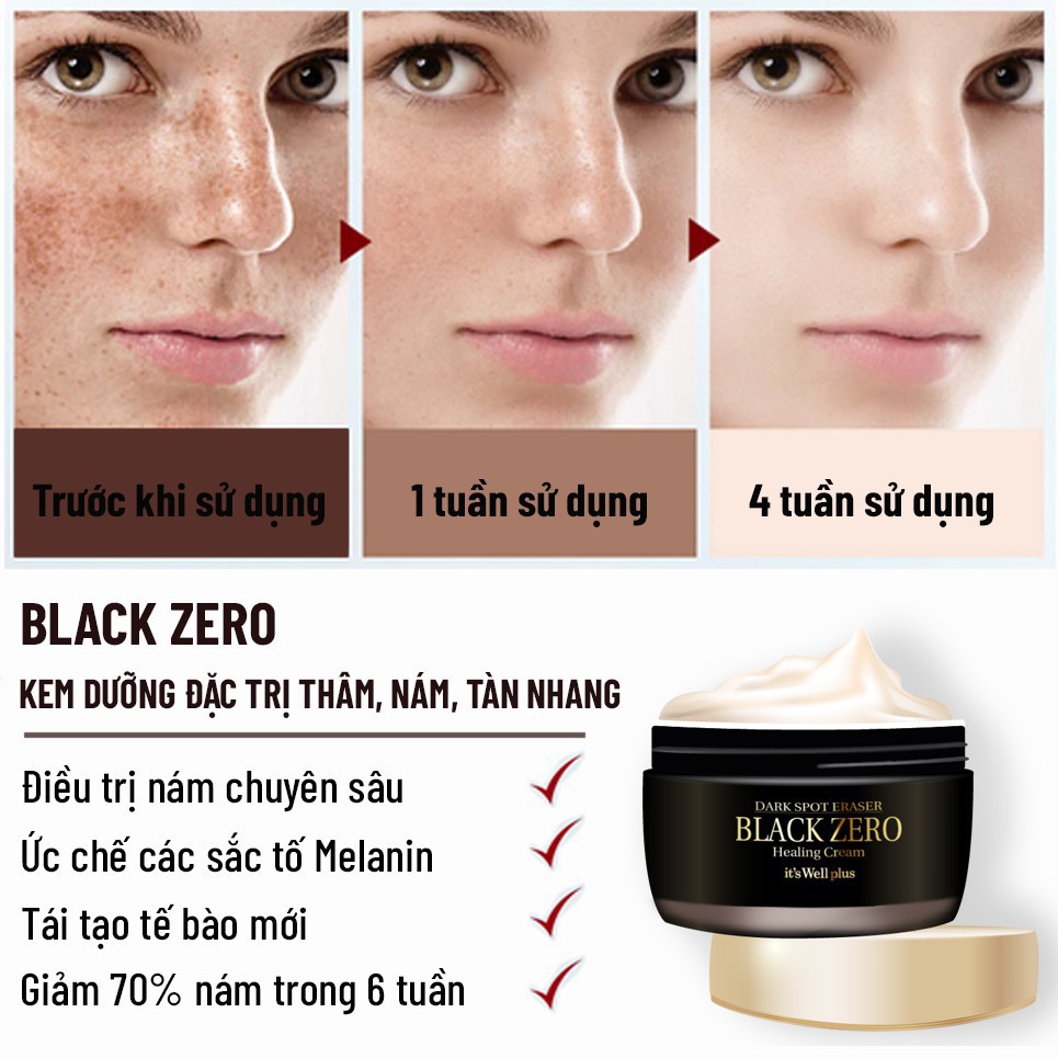 [ HÀNG CHÍNH HÃNG 100% ] Kem trị nám tàn nhang lâu năm its Well plus 30g - Dark Spot Eraser Black Zero Healing Cream