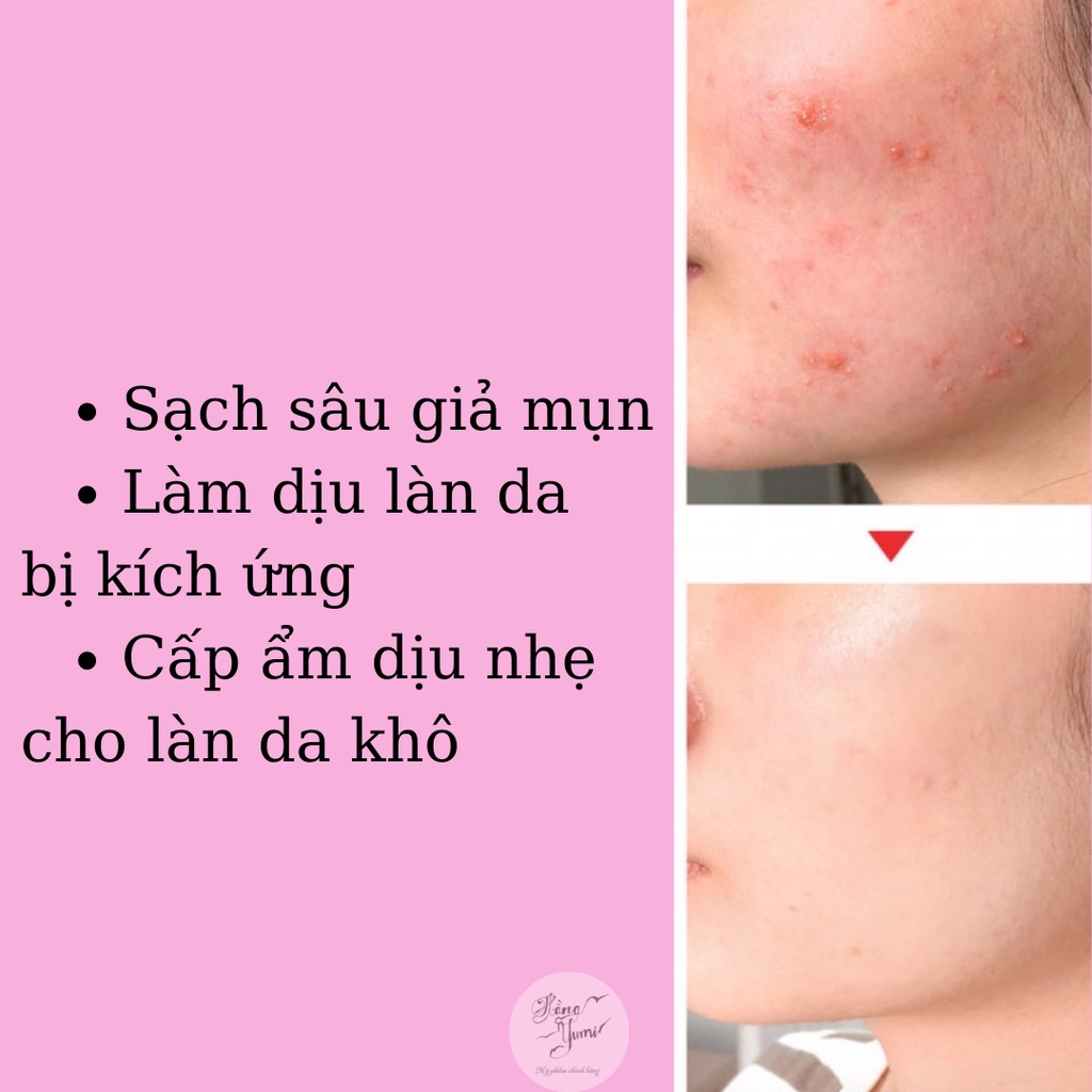 Sữa rửa mặt cho da mụn Some By Mi AHA-BHA-PHA 30 Days Miracle Acne Clear Foam 100ml
