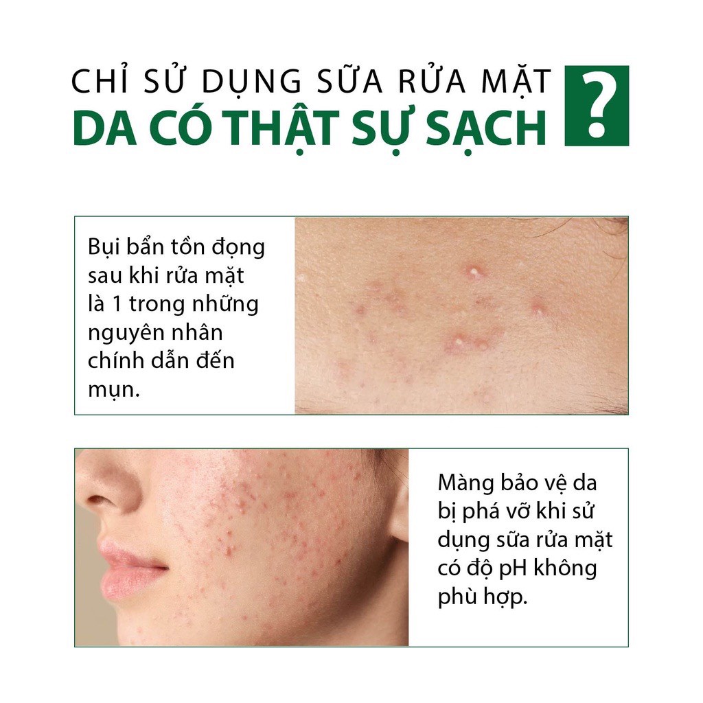 Mặt nạ Diếp Cá SUZIKO dưỡng ẩm trắng da 50g