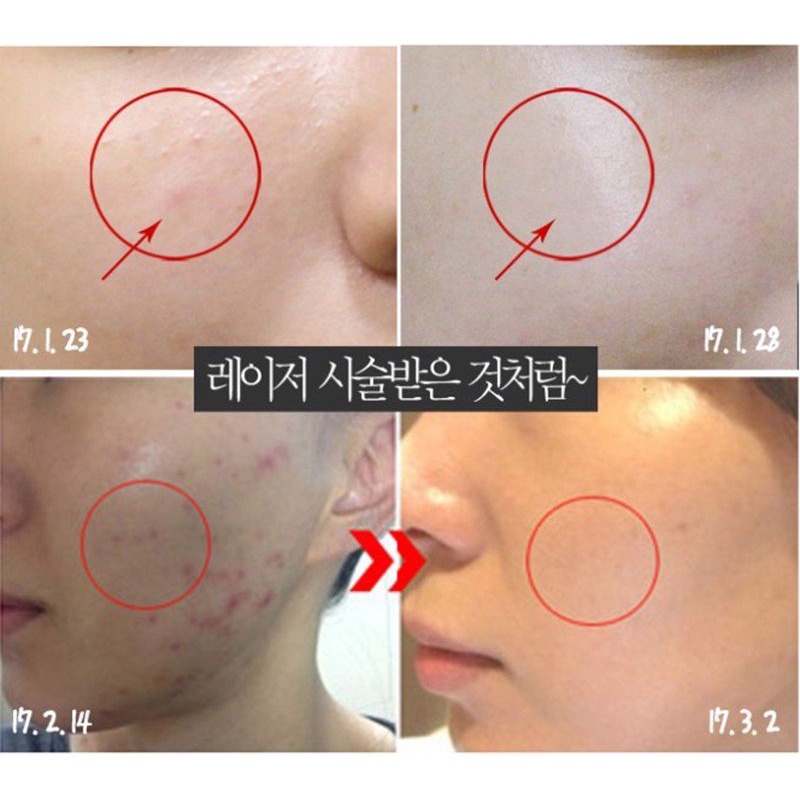 Kem Dưỡng Medi Peel Centella Giảm Mụn Phục Hồi Da Rau Má - Tuýp 30ml