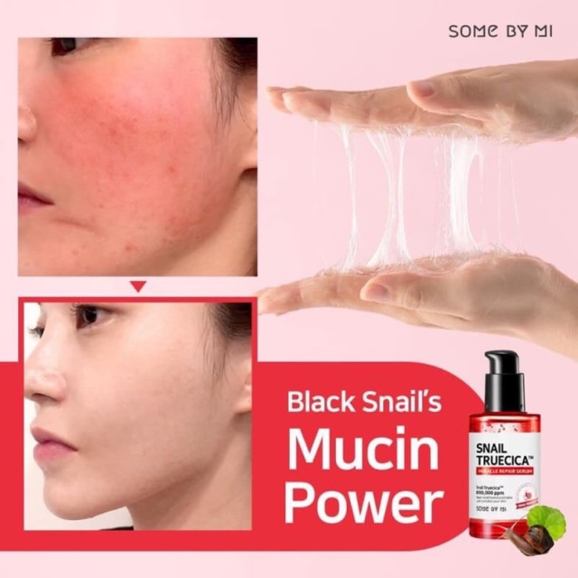 à¸à¸¥à¸à¸²à¸£à¸à¹à¸à¸«à¸²à¸£à¸¹à¸à¸�à¸²à¸à¸ªà¸³à¸«à¸£à¸±à¸ Some By Mi Snail True Cica Miracle Repair Serum 50 ml.