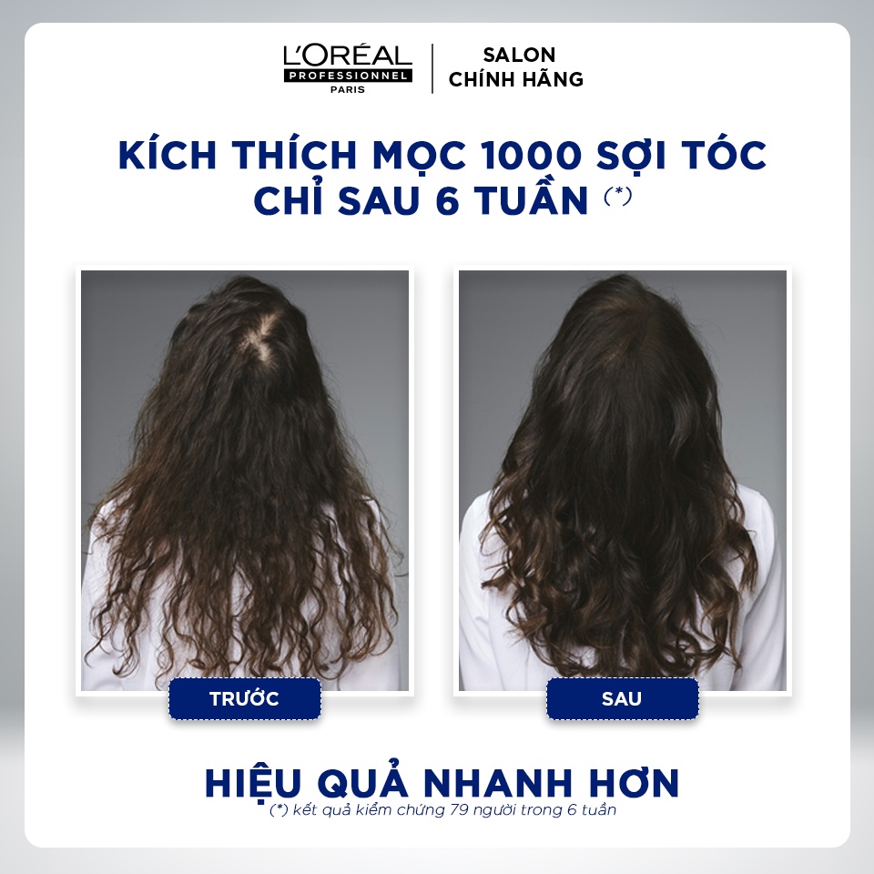 Dầu xả kích thích mọc tóc và giúp làm dày tóc Serioxyl 150ml Loreal Profession - Global Hair