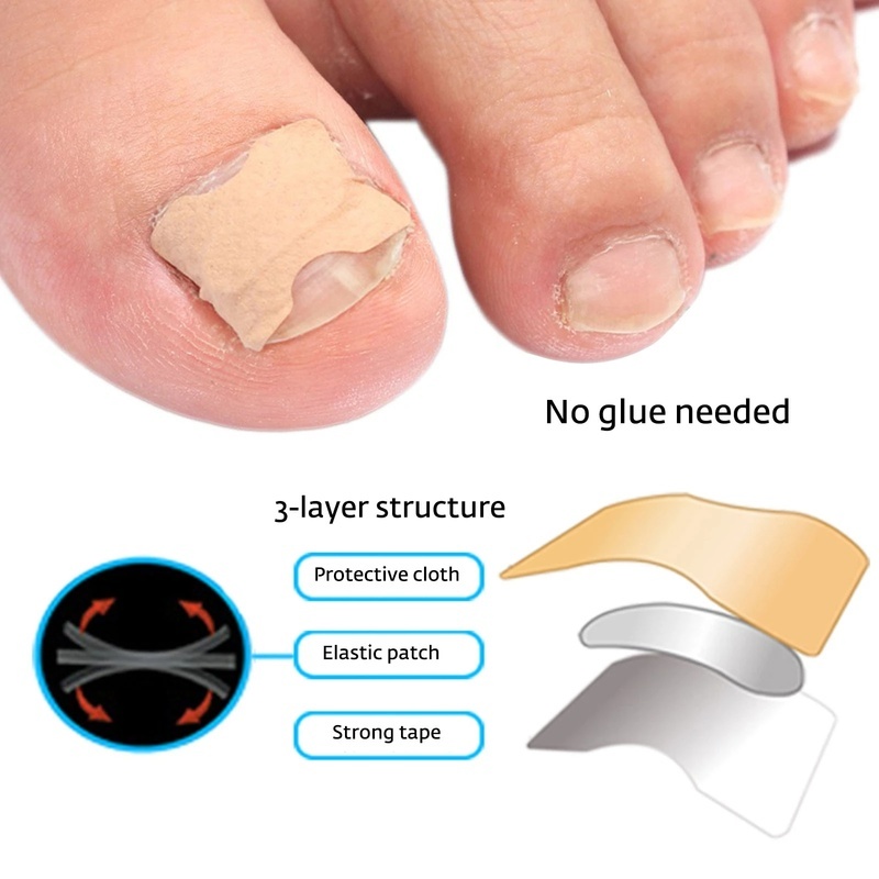 1 Set Miếng Dán Chỉnh Hình Móng Chân Mềm Mại Đàn Hồi Tự Dính