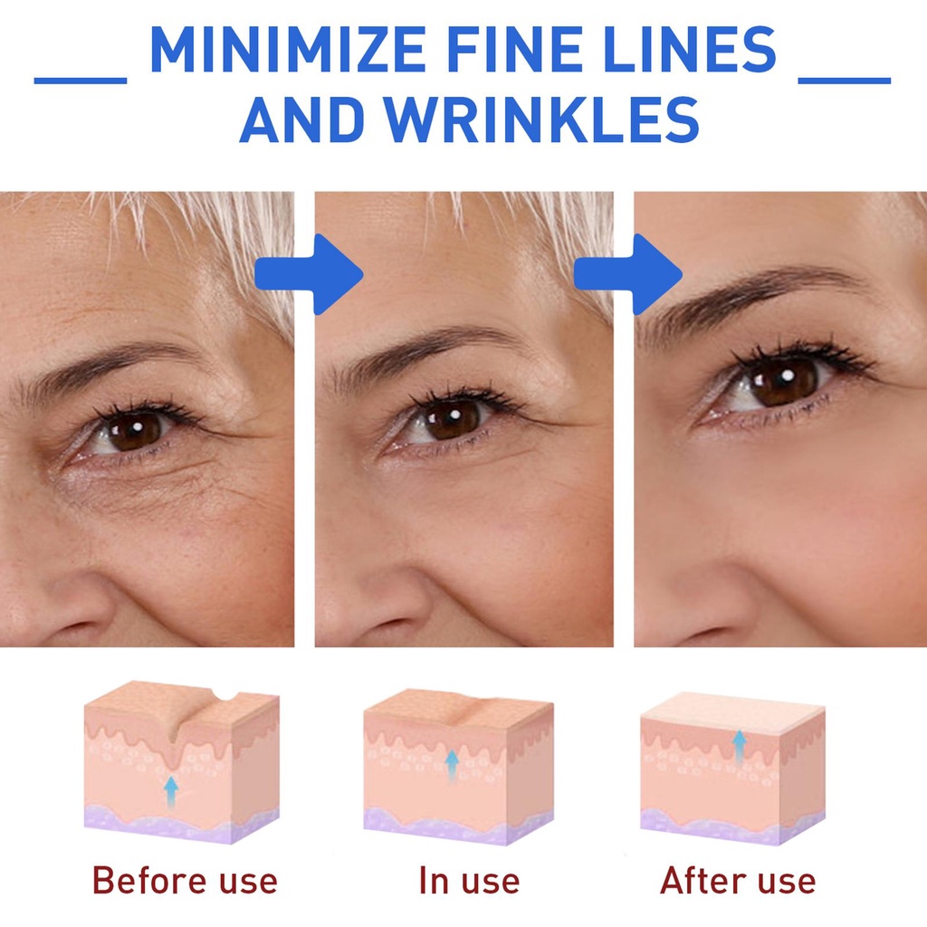 Serum Botox 30ml Chống Lão Hóa Và Nếp Nhăn Giúp Da Săn Chắc Trắng Sáng