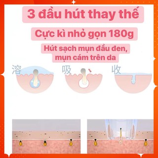 Máy hút mụn mini nhỏ gọn, máy hút mụn đầu đen, mụn cám đa chức năng