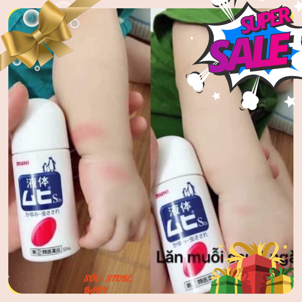 🐝🐝🐝LĂN TRỊ NỐT MUỖI ĐỐT MUHI - Nhật, Không mùi, không làm gây kích