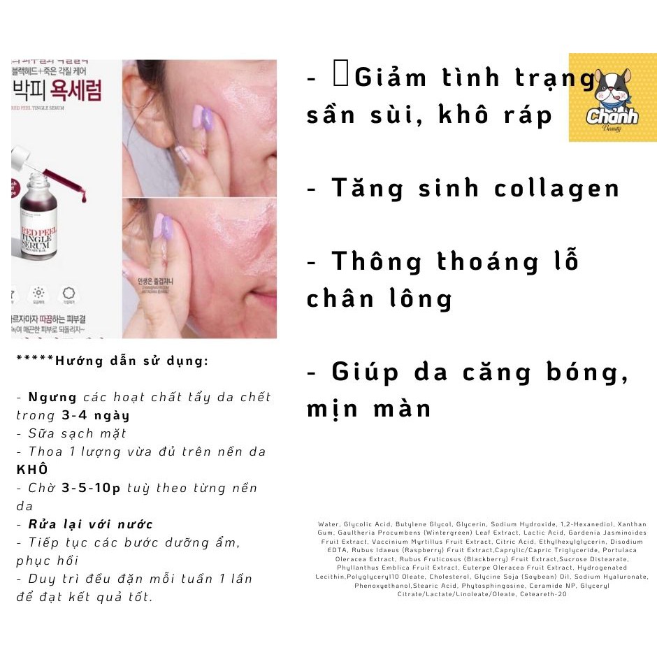 Tẩy Da Chết Hóa Học So' Natural Red Peel Tingle Serum