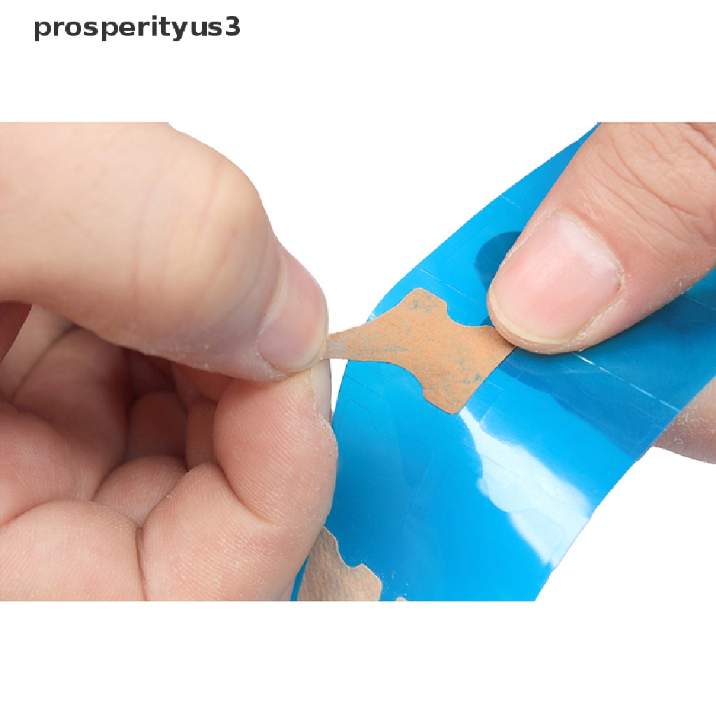 [prosperityus3] Ingrown Toenail Correction Tool Toe Nail Treatment Elastic Patch Sticker Clip [new]