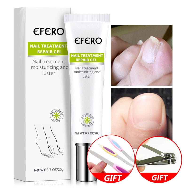 [Hàng mới về] Serum dưỡng loại bỏ nấm móng chân móng tay chống nhiễm trùng