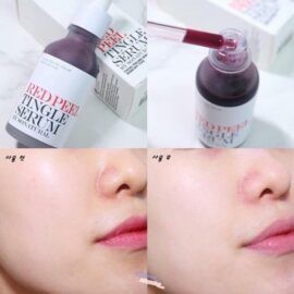 Sample [Gói] Red Peel Tingle Serum | BigBuy360 - bigbuy360.vn