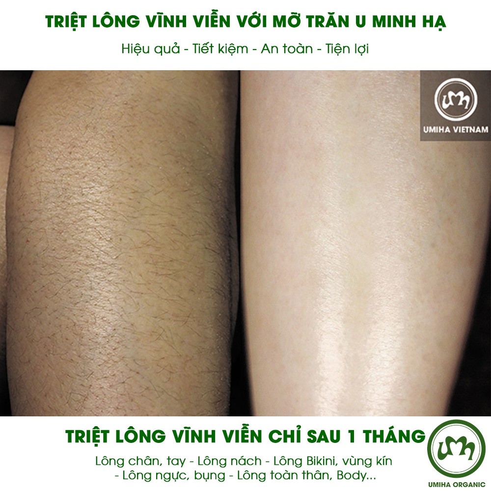 Triệt lông vĩnh viễn Toàn thân Body UMIHA ORGANIC tại nhà với Mỡ trăn U Minh Hạ (30ml) và Kem tẩy lông Umi 4C (100mlx2)