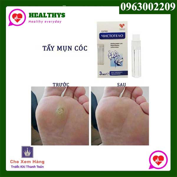 𝐓𝐡𝐮𝐨̂́𝐜 hỗ trợ 𝐭𝐫𝐢̣ nốt ruồi , mụn cóc , mụn cơm , mụn thịt (Chính Hãng) và kem hỗ trợ làm mờ seo nga