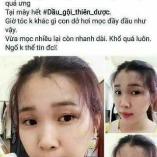 Dầu gội Đông y thiên dược