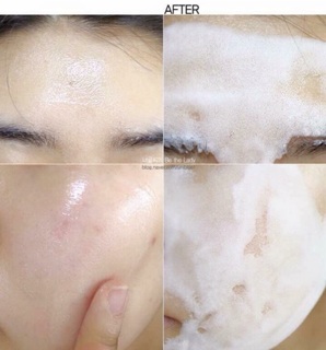 Mặt nạ thải độc sủi bọt su:m