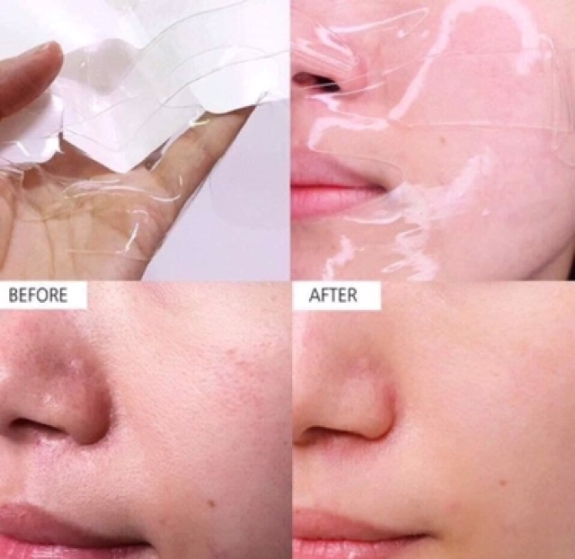 MẶT NẠ CELDERMA HỒNG❤️FREESHIP❤️MẶT NẠ THẠCH SINH HỌC CELDERMA NINETALKS | Thế Giới Skin Care