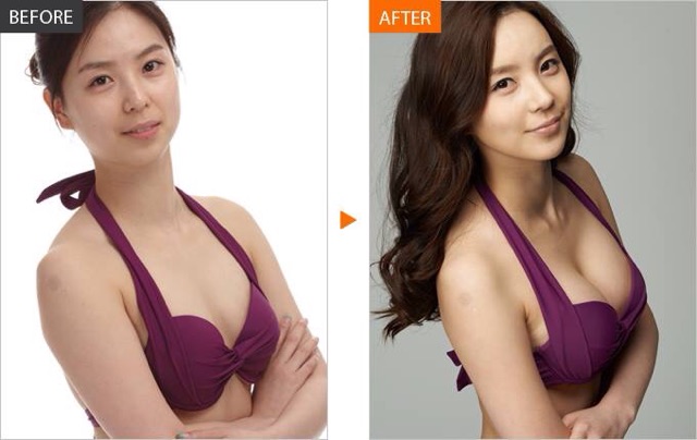 Kem Nở Ngực Upsize hàng chính hãng Nga nữ | BigBuy360 - bigbuy360.vn