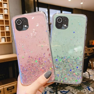 ốp điện thoại Trong Suốt Cho Xiaomi Mi 11 Lite 11 Pro 11 Ultra 11lite Mi11Lite