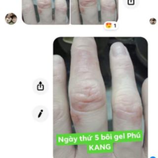 Gel bôi da Phú KANG