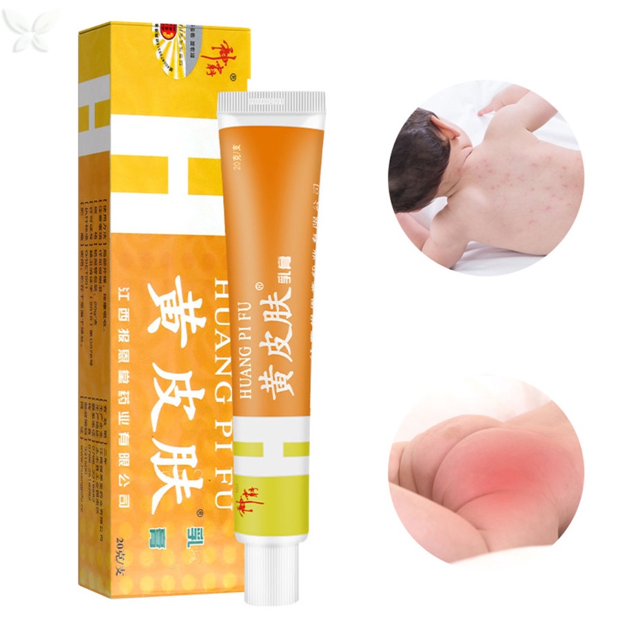 Kem Thảo Dược Hỗ trợ giảm vẩy nến / Chàm Chống Ngứa Hiệu Quả