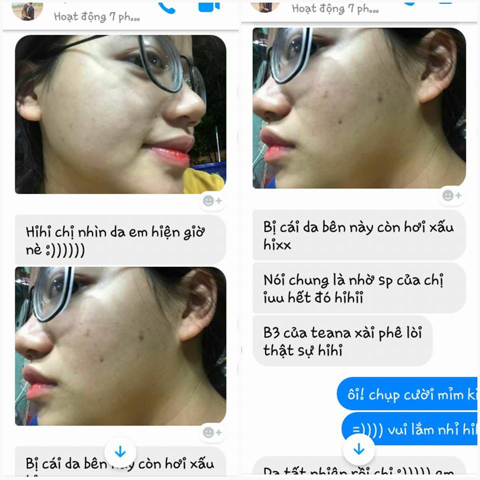 Serum Teana B3, GIẢM VIÊM, MỜ THÂM MỤN | BigBuy360 - bigbuy360.vn