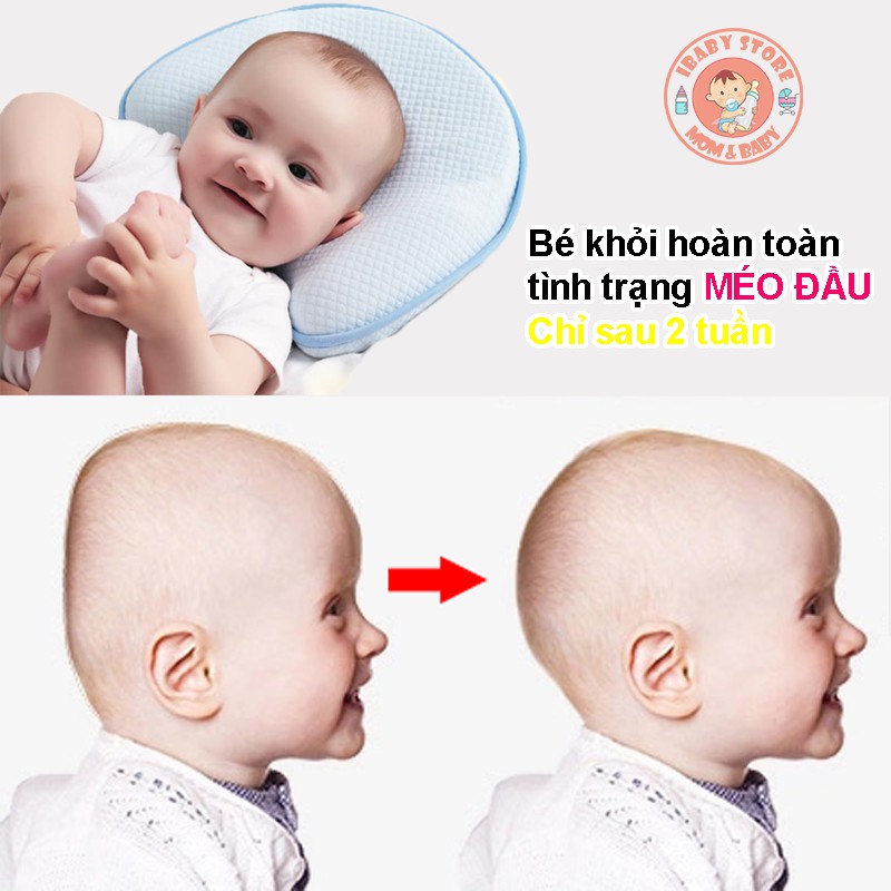 Trợ giá - Gối cao su non chống méo đầu babymoov ( chính hãng )