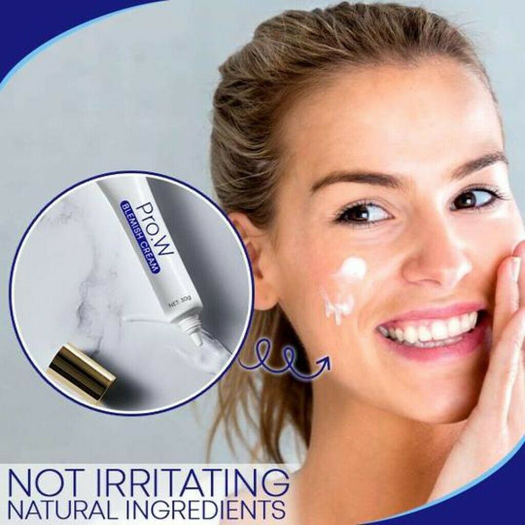 Kem dưỡng trắng da ANNIES 30ml giúp làm mờ sẹo và vết thâm hiệu quả