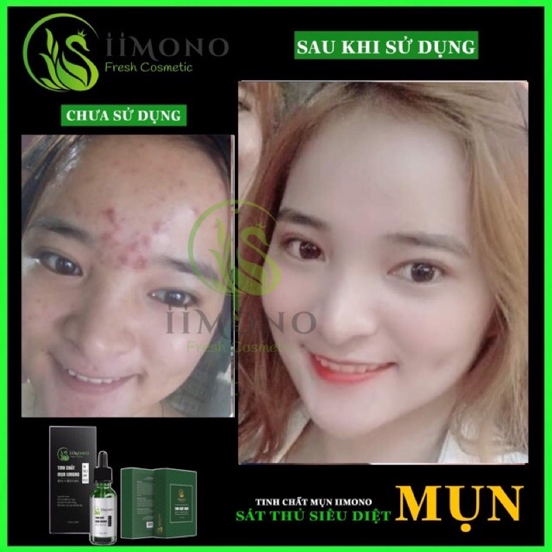 Tinh chất mụn IIMONO 6ml | BigBuy360 - bigbuy360.vn