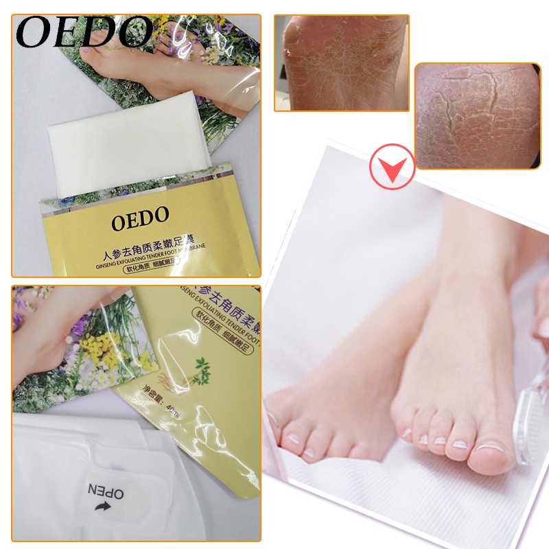 Bộ 6 mặt nạ chân OEDO chiết xuất nhân sâm tẩy tế bào chết làm trắng sáng da | BigBuy360 - bigbuy360.vn