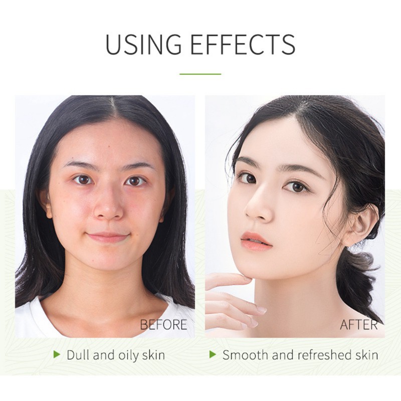 [Hàng mới về] Bộ 12 Mặt Nạ Bùn Trà Xanh Làm Sạch Mụn Đầu Đen Và Lỗ Chân Lông
