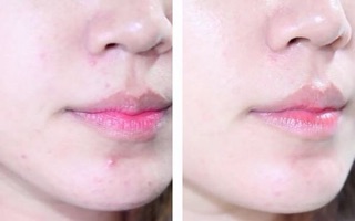 Nước hoa hồng diếp cá nhật bản