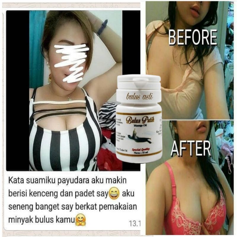 Tinh Dầu Nở Ngực Bpom Trắng Chăm Sóc Da Cho Nữ | BigBuy360 - bigbuy360.vn