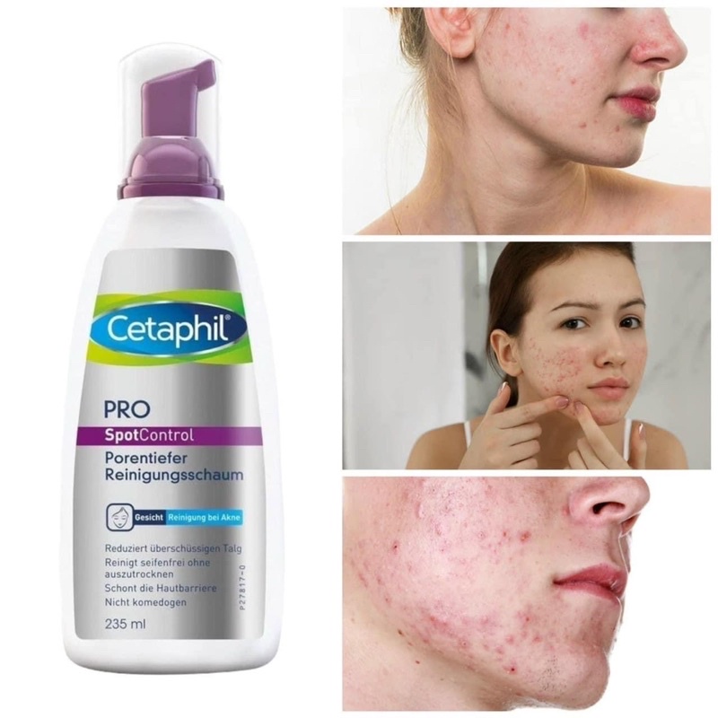Sữa rữa mặt tạo bột Cetaphil Gentle foaming cleanser/Derma control 236ml