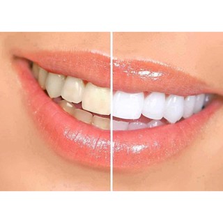 Kem Đánh Trắng Răng Crest 3D White Fluoride Anticavity Tooth-Paste