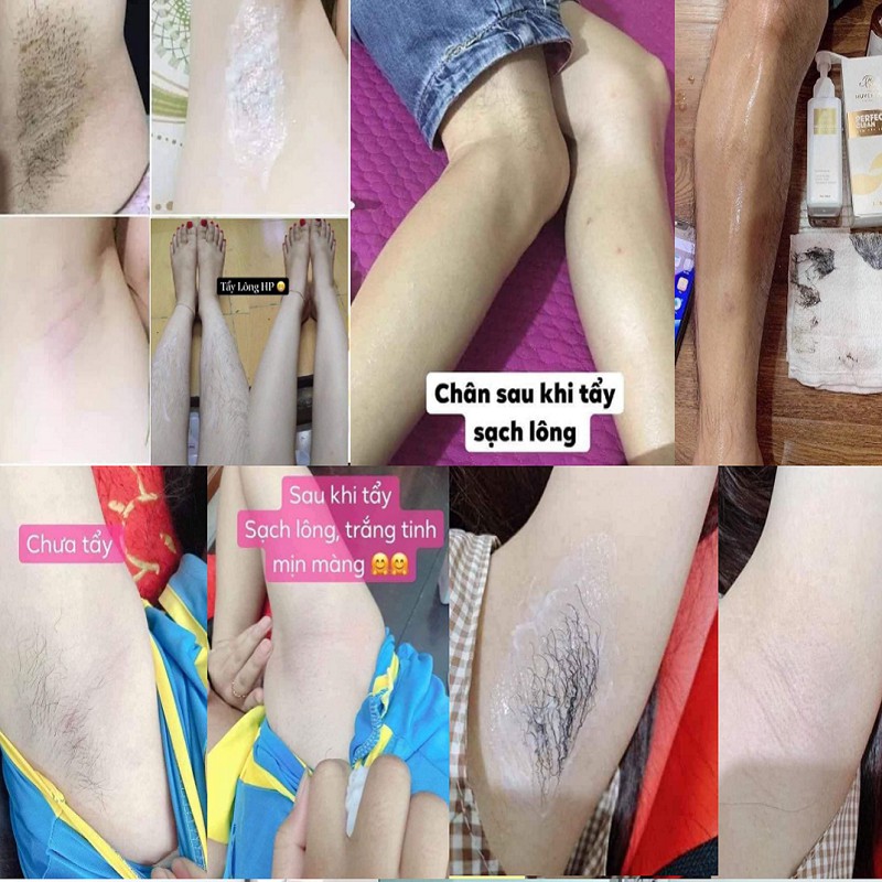 ☀️MUA 1 ĐƯỢC 2☀️Kem Tẩy Lông Huyền Phi - Triệt sạch Lông Nách, Lông Chân, Lông Tay, Bikini | BigBuy360 - bigbuy360.vn