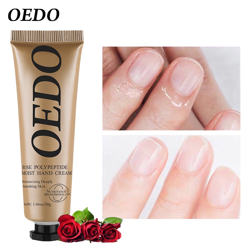 Kem dưỡng trắng da tay OEDO dưỡng ẩm chống Lão Hóa Giảm Khô Và Thô Ráp tinh chất hoa hồng giúp dưỡng da tay 30g