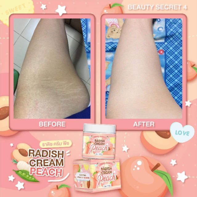 Kem Ngăn Ngừa Thâm, Rạn Da, Mờ Sẹo, Dưỡng Trắng Toàn Thân RADISH CREAM PEACH Beauty Secret 4 100g - Thái Lan | BigBuy360 - bigbuy360.vn