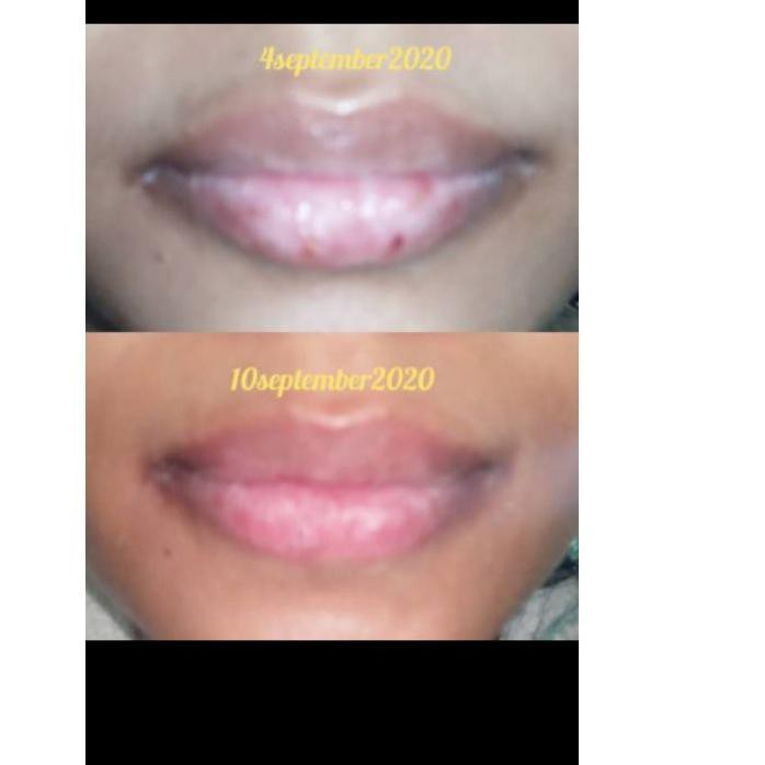 X (Hàng Mới Về) Son Dưỡng Môi Tinh Chất Sáp Ong Chăm Sóc Da Cho Mẹ Và Bé | BigBuy360 - bigbuy360.vn