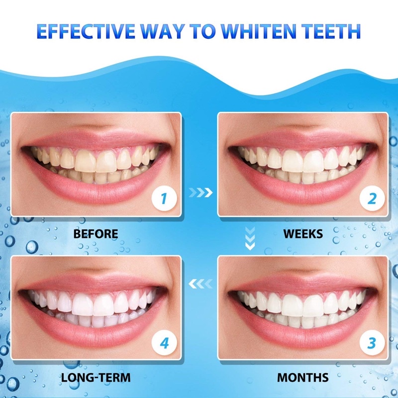 Miếng dán Crest 3D White strips làm trắng răng hiệu quả, an toàn