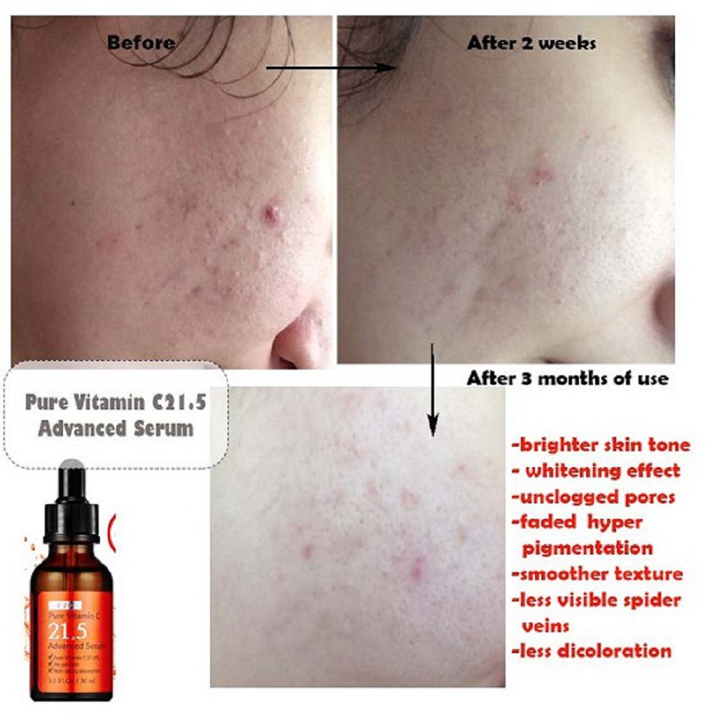 Tinh Chất Dưỡng Trắng By Wishtrend C21.5 Advanced Serum 30ml | BigBuy360 - bigbuy360.vn