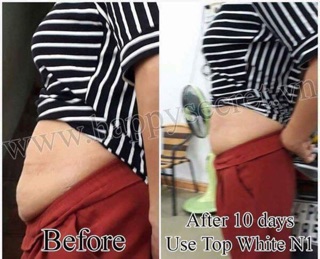 Hot gel top white