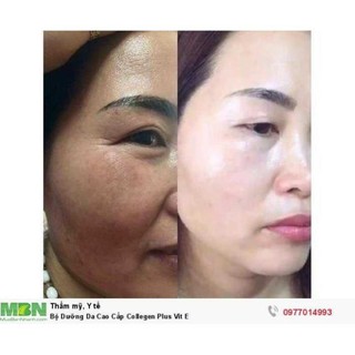Bộ kem cao cấp colagen Plus Vit e