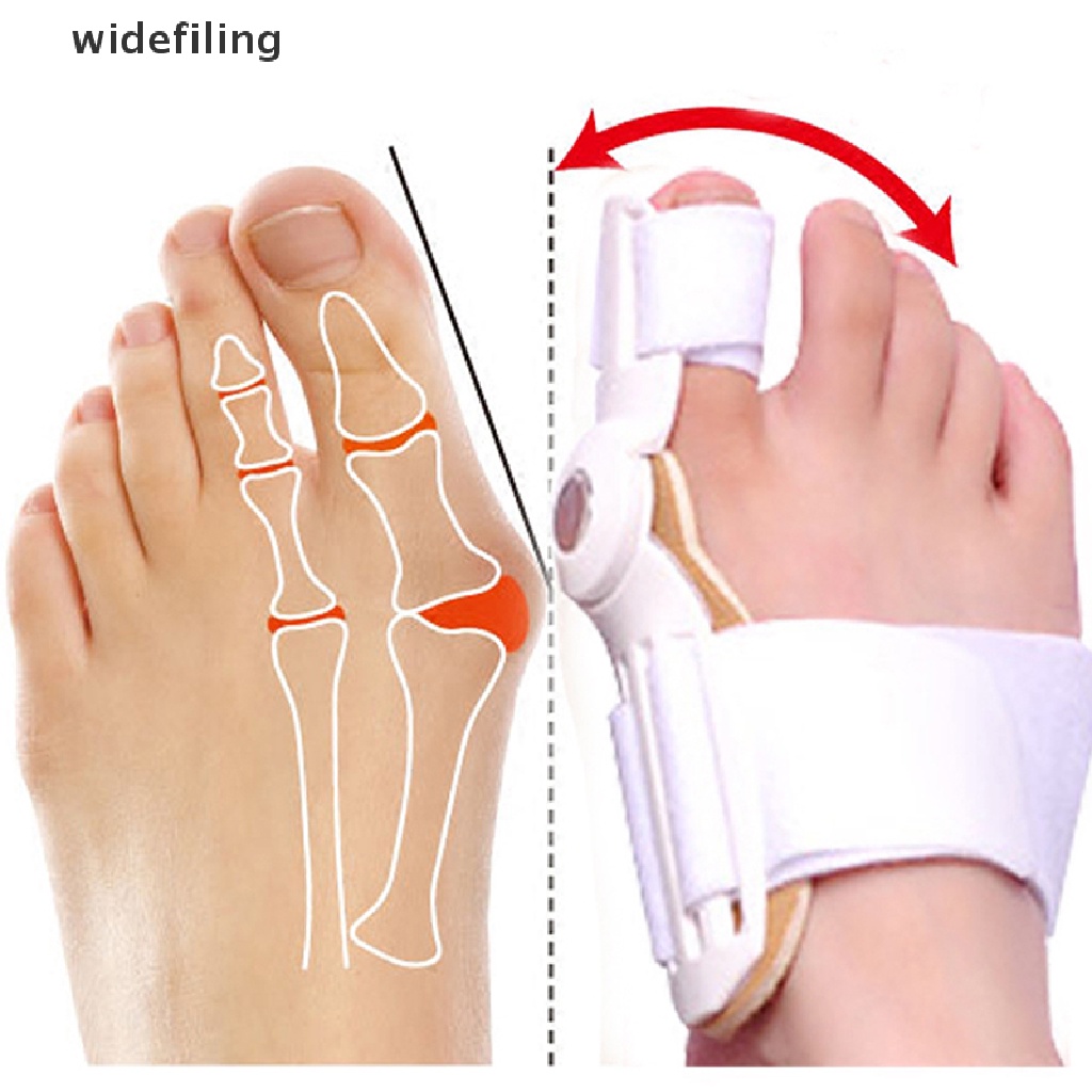 Dụng Cụ Nẹp Chỉnh Hình Ngón Chân Cái Tiện Dụng<br>