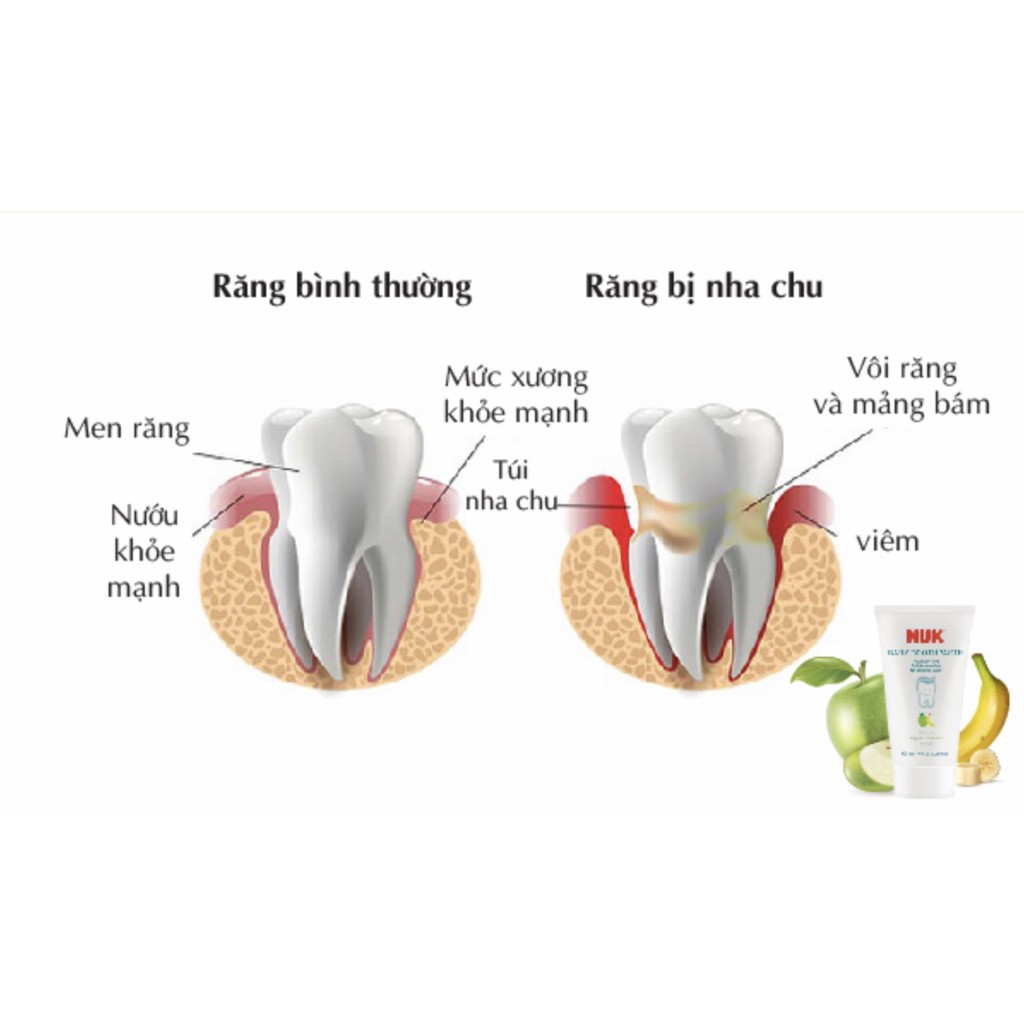 (Chính hãng) Bộ bàn chải kem đánh răng NUK cho bé 3 - 36 tháng tuổi