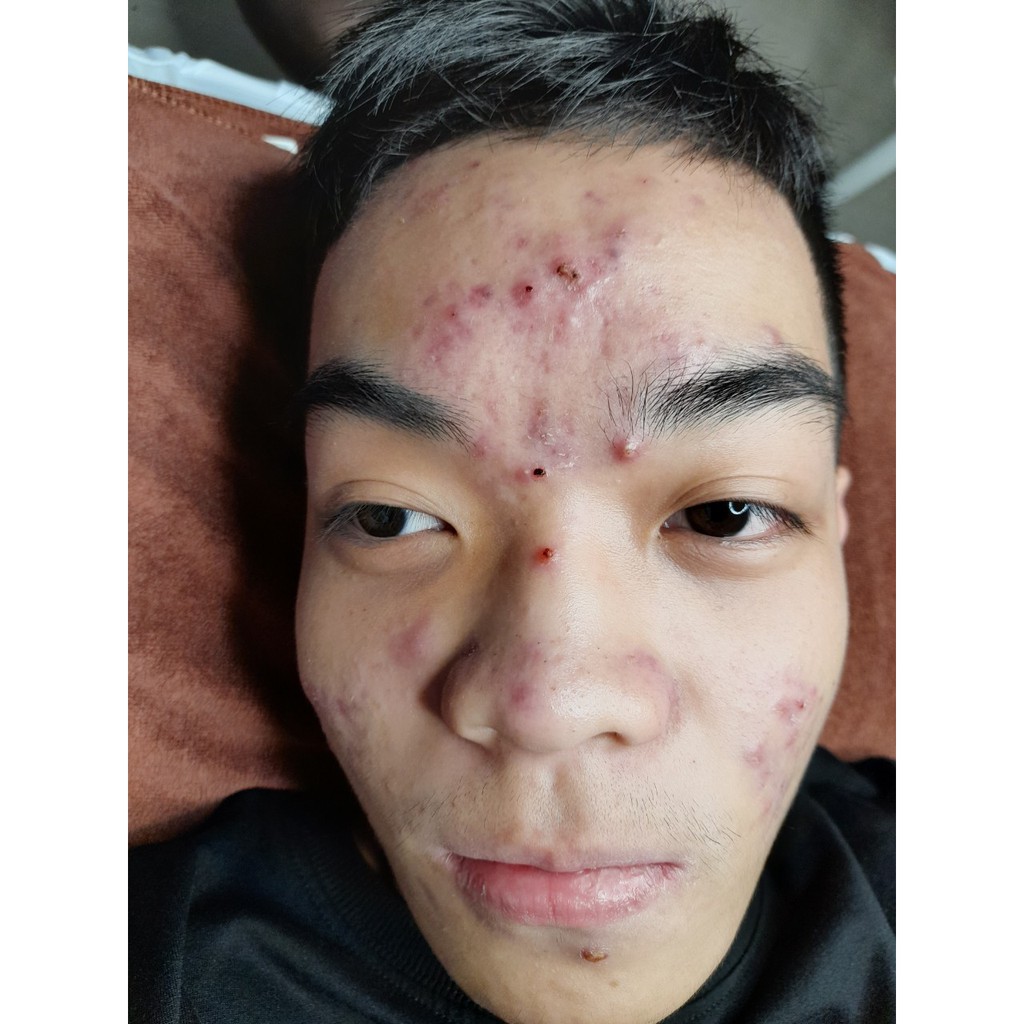 Serum đường đen