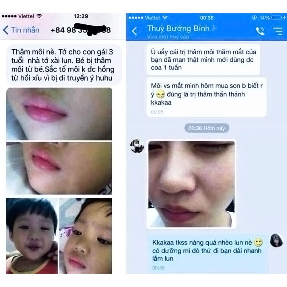 Tinh dầu Linh Hương làm mờ vết thâm da do sẹo, mụn ở mặt đầu gối, nách, nhũ hoa, côn trùng cắn 30ml | BigBuy360 - bigbuy360.vn